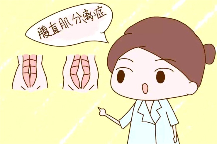 腹直肌分離問題，產(chǎn)后康復(fù)治療儀幫助您