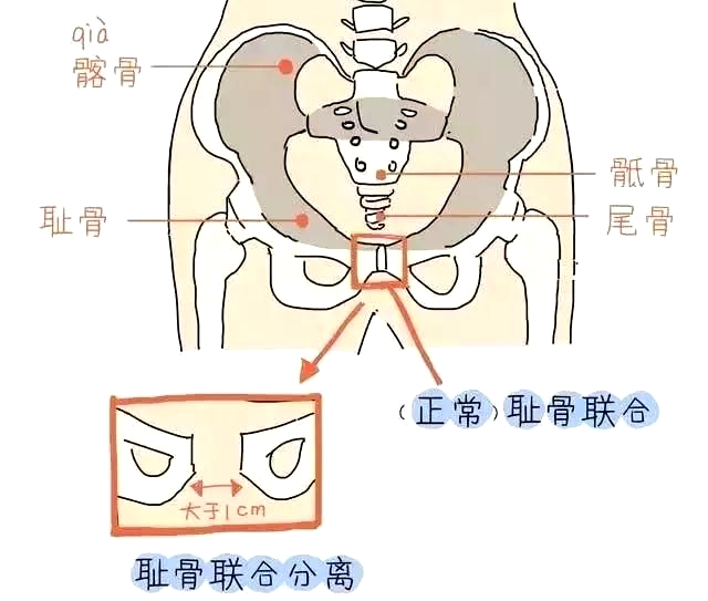 盆底肌康復(fù)治療儀，產(chǎn)后媽媽不再擔(dān)心