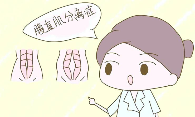 腹直肌分離，產(chǎn)后康復(fù)治療儀幫您
