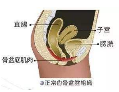 產(chǎn)后盆底肌怎么修復(fù)？你得做好盆底功能檢測