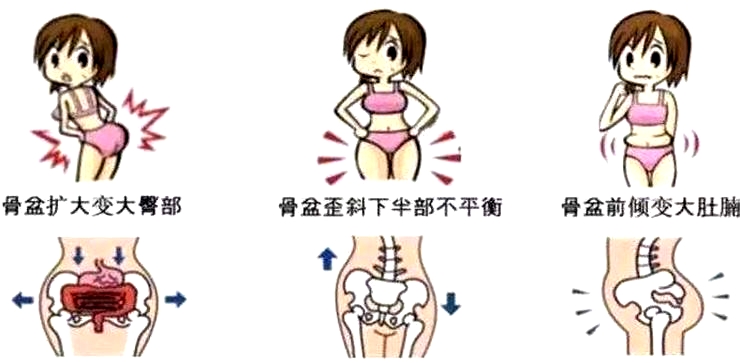 盆底康復(fù)治療怎么做，盆底治療儀是關(guān)鍵點