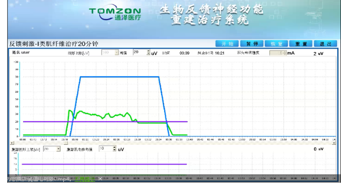盆底康復治療怎么做？盆底康復治療肌電生物反饋治療儀的機理是什么？