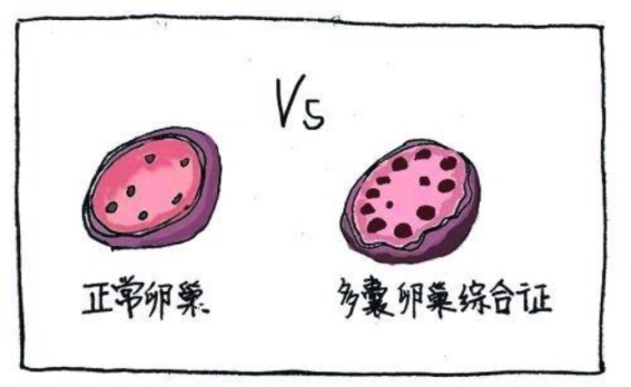 盆底肌康復(fù)治療怎么做，盆底肌修復(fù)十大常見問題（下）