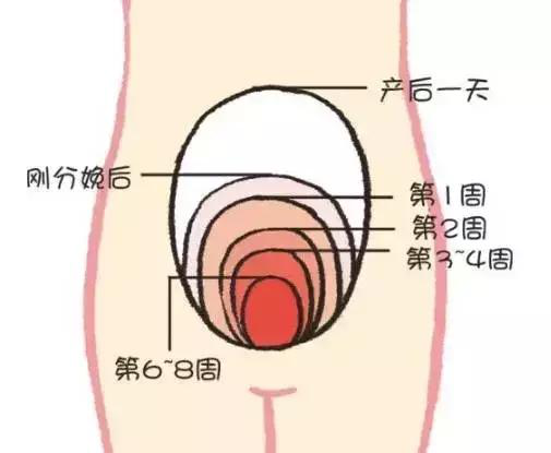 產(chǎn)后康復(fù)，什么叫子宮復(fù)舊不良？