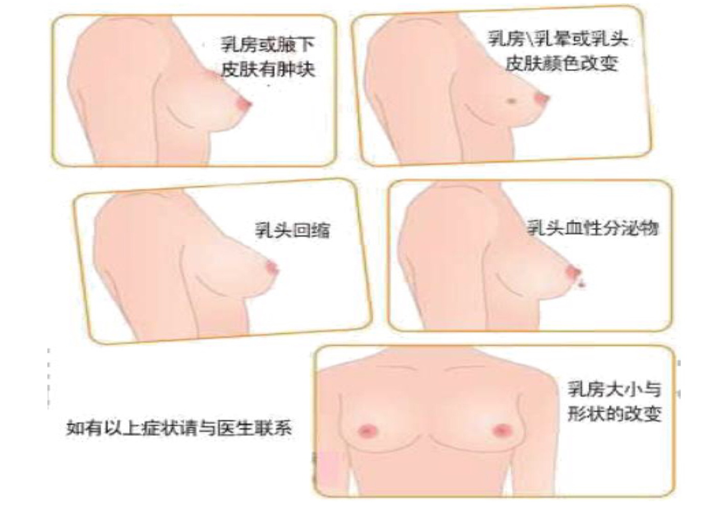 對產(chǎn)婦產(chǎn)后康復(fù)的效果，便攜產(chǎn)后康復(fù)治療儀的作用遠不如此