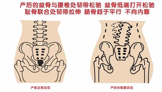 自從知道產(chǎn)后康復(fù)治療儀后，再也不怕腹直肌修復(fù)了