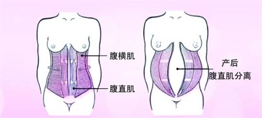 產(chǎn)后修復中心小型變大型，母乳分析儀器是專業(yè)性的體現(xiàn)