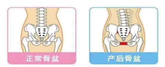 別大意！進行產后修復項目，要選擇專業(yè)的產后修復中心