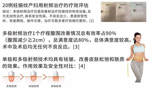 通澤產(chǎn)后塑形儀器，多極射頻破解辣媽逆齡秘訣