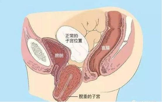 產后康復是否可以選擇儀器？