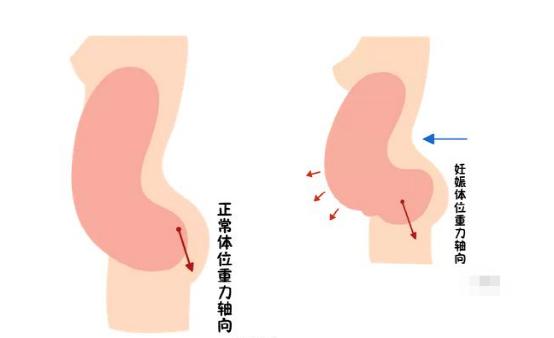 盆底恢復(fù)是否可以使用儀器？