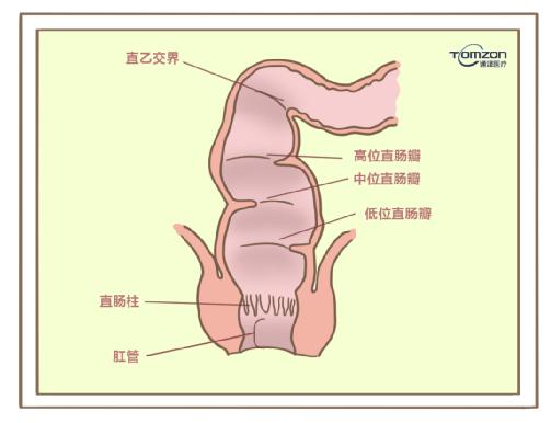 盆底康復(fù)治療儀對(duì)產(chǎn)后便秘有哪些幫助？