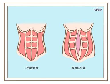 盆底康復(fù)治療儀效果到底怎么樣？