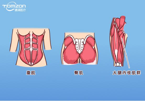 凱格爾運(yùn)動(dòng)該怎么做？盆底肌修復(fù)儀器還能用嗎？