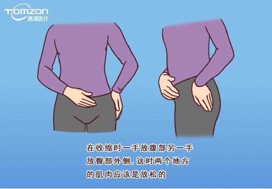 盆底康復(fù)治療儀能不能改善腹直肌分離？