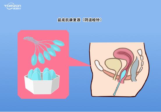 如有盆底高張者，不做力量提升型運(yùn)動(dòng)，否則容易加重盆底損傷。建議在做盆底康復(fù)運(yùn)動(dòng)前，先進(jìn)行盆底肌肉檢測(cè)