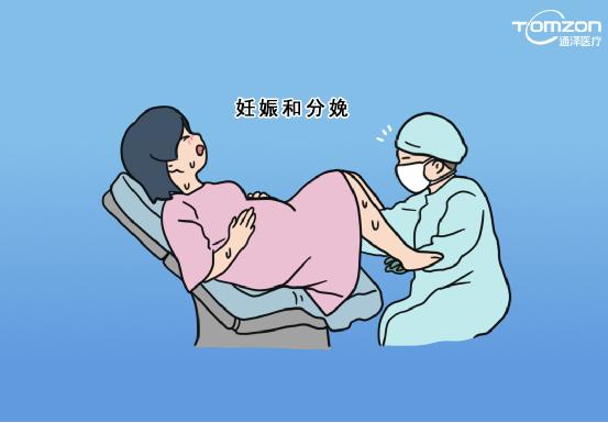 盆底康復(fù)治療儀是否可以促進(jìn)盆底肌肉康復(fù)？