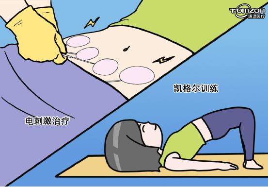 產(chǎn)后便秘怎么辦？盆底肌修復(fù)儀器來(lái)治療