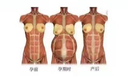 產(chǎn)后康復治療